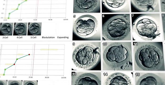 Time-lapse Imaging